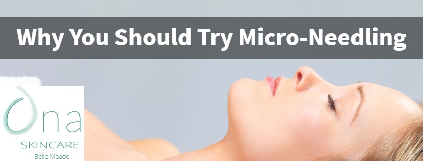 Why You Should Try Micro-needling