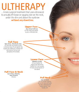 Ultherapy - Non-Surgical Procedure