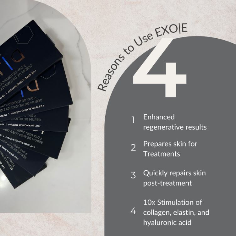 Reasons to use EXOE infographic
