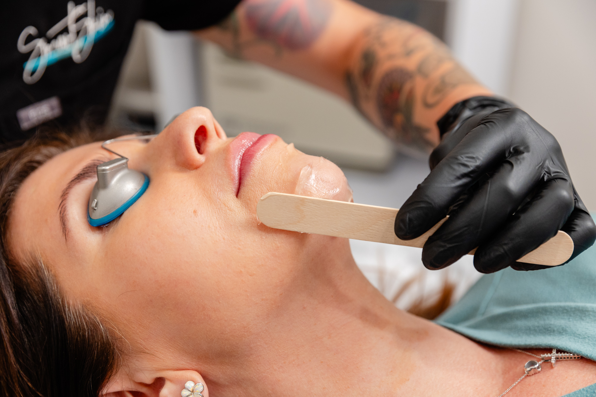 A provider smooths gel over the patient's chin prior to laser hair reduction near Brentwood.