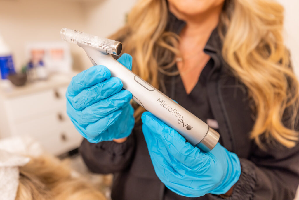 Close up of a medical provider holding a device for RF microneedling in East Nashville at Ona Skincare.