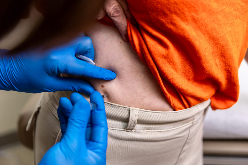Close up of weight loss injections in Nashville being administered to a patient's stomach by gloved hands.